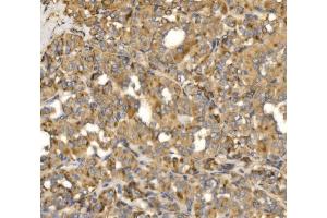 IHC analysis of MLX-interacting protein/MLXIP using anti-MLX-interacting protein/MLXIP antibody (ABIN7602593). (MLXIP antibody  (AA 88-348))