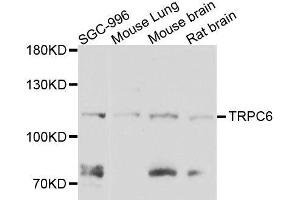 Western blot analysis of extracts of various cell lines, using TRPC6 antibody. (TRPC6 antibody  (AA 500-600))
