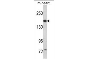 Western blot analysis of CORIN Antibody in mouse heart tissue lysates (35ug/lane) (Corin antibody  (AA 459-490))