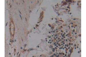 Immunohistochemistry (IHC) image for anti-Nucleoporin 155kDa (NUP155) (AA 1154-1379) antibody (ABIN7444085)