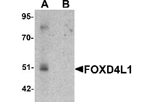 Western blot analysis of FOXD4L1 in A-20 cell lysate with FOXD4L1 antibody at 1 µg/mL in (A) the absence and (B) the presence of blocking peptide.