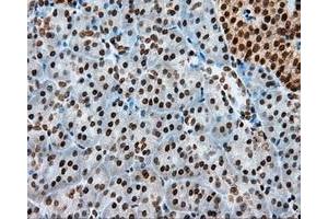 Immunohistochemical staining of paraffin-embedded colon tissue using anti-MCL1 mouse monoclonal antibody. (MCL-1 antibody)