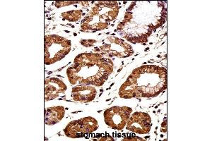CTNNB1 Antibody (C-term) immunohistochemistry analysis in formalin fixed and paraffin embedded human stomach tissue followed by peroxidase conjugation of the secondary antibody and DAB staining. (CTNNB1 antibody  (C-Term))