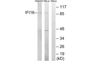 Western blot analysis of extracts from HeLa cells and HepG2 cells, using IFI16 antibody.