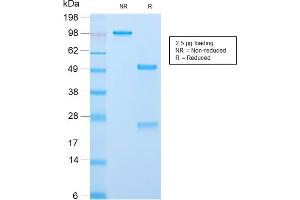 SDS-PAGE Analysis Purified ACTH Rabbit Recombinant Monoclonal Antibody (CLIP/2859R). (Recombinant POMC antibody  (AA 25-39))