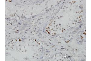 Immunohistochemistry (Formalin-fixed Paraffin-embedded Sections) (IHC (fp)) image for anti-Bromodomain Containing 3 (BRD3) (AA 418-556) antibody (ABIN563516)