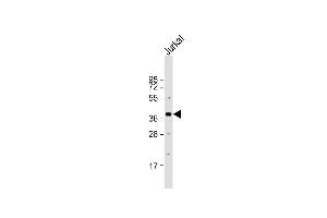 Anti-LEF1 Antibody (N-term) at 1:2000 dilution + Jurkat whole cell lysate Lysates/proteins at 20 μg per lane. (LEF1 antibody  (N-Term))