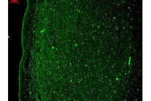 Immunofluorescence (IF) image for anti-Potassium Voltage-Gated Channel, KQT-Like Subfamily, Member 4 (KCNQ4) (N-Term) antibody (ABIN6656738)