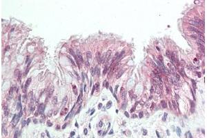 Human Bronchus: Formalin-Fixed, Paraffin-Embedded (FFPE) (ALPK1 antibody  (AA 11-60))