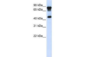 Western Blotting (WB) image for anti-MYC-Associated Zinc Finger Protein (Purine-Binding Transcription Factor) (MAZ) antibody (ABIN2458297) (MAZ antibody)