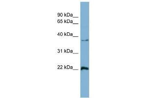 Ran antibody used at 1 ug/ml to detect target protein. (RAN antibody  (Middle Region))