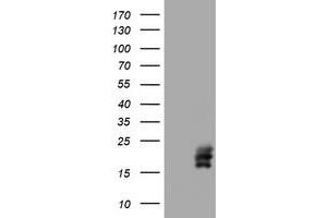 Image no. 1 for anti-Chorionic Gonadotropin, beta Polypeptide (CGB) (AA 21-165) antibody (ABIN1491188)