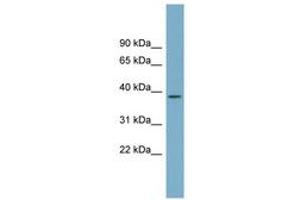 Image no. 1 for anti-Serine Dehydratase-Like (SDSL) (N-Term) antibody (ABIN6743387)