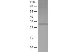 Western Blotting (WB) image for Upstream Transcription Factor 1 (USF1) (AA 1-310) protein (His tag) (ABIN7285675) (USF1 Protein (AA 1-310) (His tag))