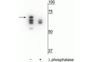 Western blot of T47D cell lysate treated with EGF (1 nM) for 60 minutes showing specific labeling of the ~70 kDa Hsp70 in the first lane (-). (HSP70 1A antibody  (pThr153))
