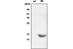 Recombinant crystallin alpha A (alphaA) and the extract of mouse eye (ME) were resolved by SDS-PAGE, transferred to PVDF membrane and probed with anti-human crystallin alpha B antibody (1:1,000). (CRYAB antibody  (AA 1-175))