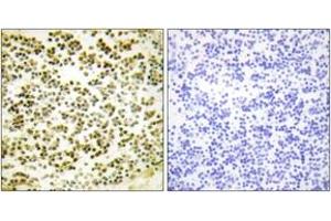 Immunohistochemistry analysis of paraffin-embedded human lymph node, using RBL1 (Phospho-Thr369) Antibody. (p107 antibody  (pThr369))