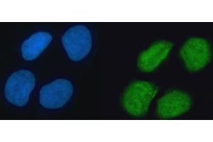 IF analysis of hnRNP K/HNRNPK using anti-hnRNP K/HNRNPK antibody (ABIN7601650). (HNRNPK antibody  (AA 40-463))