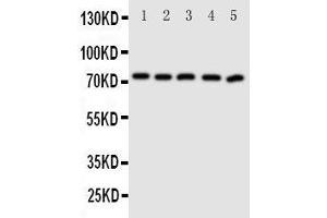 Western Blotting (WB) image for anti-ATP-Binding Cassette, Sub-Family G (WHITE), Member 5 (ABCG5) (AA 116-131), (N-Term) antibody (ABIN3044097) (ABCG5 antibody  (N-Term))