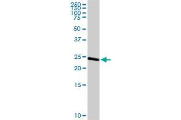 ARHGDIA antibody  (AA 1-204)