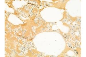 ABIN6265573 and ABIN6272896 at 1/100 staining human normal lung tissue by IHC-P. (TIMM23 antibody  (N-Term))