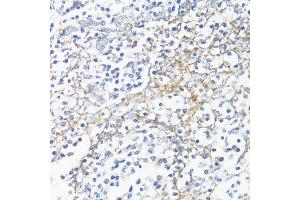 Immunohistochemistry of paraffin-embedded human tonsil using HSD17B10 antibody. (HSD17B10 antibody  (AA 1-261))