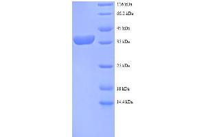 SDS-PAGE (SDS) image for Ribosomal Protein S12 (RPS12) (AA 1-132), (full length) protein (GST tag) (ABIN4974353) (RPS12 Protein (AA 1-132, full length) (GST tag))
