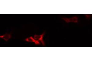 ABIN6274401 staining HuvEc by IF/ICC. (Sideroflexin 4 antibody  (N-Term))