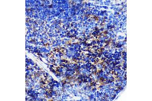 Immunohistochemistry (IHC) image for anti-SWAP Switching B-Cell Complex 70kDa Subunit (SWAP70) (AA 316-585) antibody (ABIN7270654)