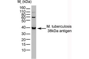 Image no. 1 for anti-Mycobacterium Tuberculosis, 38kDa antibody (ABIN304017) (Mycobacterium Tuberculosis, 38kDa antibody)
