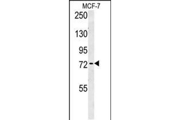 ARHGAP44 anticorps  (C-Term)