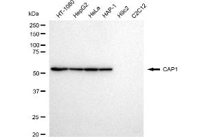 Western blotting analysis using CAP1 antibody (ABIN7797862).