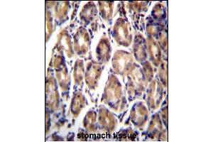 RARRES1 Antibody (C-term) (ABIN657062 and ABIN2846226) immunohistochemistry analysis in formalin fixed and paraffin embedded human stomach tissue followed by peroxidase conjugation of the secondary antibody and DAB staining. (RARRES1 antibody  (C-Term))