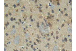 Detection of CTGF in Mouse Cerebrum Tissue using Polyclonal Antibody to Connective Tissue Growth Factor (CTGF) (CTGF antibody  (AA 245-346))
