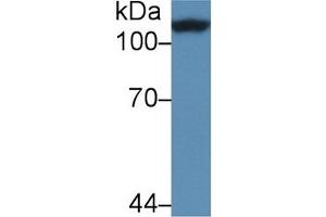 Detection of CRN in Rat Heart lysate using Polyclonal Antibody to Corin (CRN) (Corin antibody  (AA 533-634))