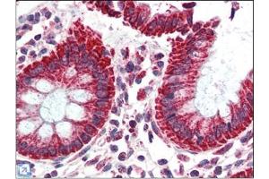 Human Colon (formalin-fixed, paraffin-embedded) stained with TSPOat 2. (TSPO antibody  (C-Term))