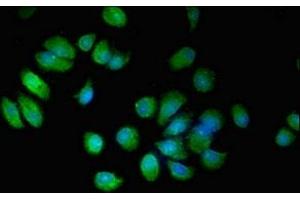Immunofluorescent analysis of MCF-7 cells using ABIN7151962 at dilution of 1:100 and Alexa Fluor 488-congugated AffiniPure Goat Anti-Rabbit IgG(H+L) (EPN3 antibody  (AA 25-208))