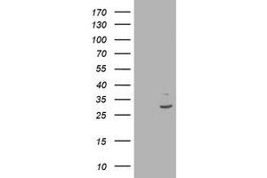 HEK293T cells were transfected with the pCMV6-ENTRY control (Left lane) or pCMV6-ENTRY IFI35 (Right lane) cDNA for 48 hrs and lysed. (IFI35 antibody)