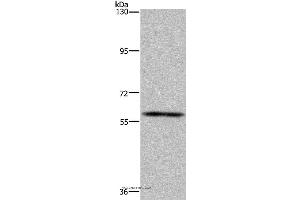 Western blot analysis of Human fetal brain tissue, using FTO Polyclonal Antibody at dilution of 1:650 (FTO antibody)