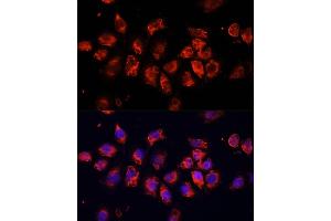 Immunofluorescence analysis of HeLa cells using SMO Polyclonal Antibody (ABIN6130715, ABIN6148140, ABIN6148141 and ABIN6220185) at dilution of 1:100 (40x lens). (SMO antibody  (AA 554-787))