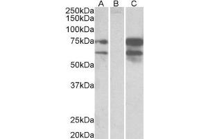 HEK293 lysate (10ug protein in RIPA buffer) overexpressing Human NRXN1 with DYKDDDDK tag probed with ABIN2564097 (0. (Neurexin 1 antibody  (C-Term))