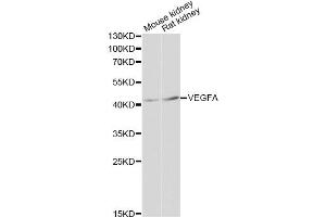 Western blot analysis of extracts of various cell lines, using VEGFA antibody (ABIN5999168) at 1:3000 dilution. (VEGF antibody)