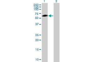 Western Blot analysis of EVC expression in transfected 293T cell line by EVC MaxPab polyclonal antibody. (EVC antibody  (AA 1-535))
