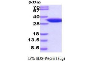 SDS-PAGE (SDS) image for Hydroxyprostaglandin Dehydrogenase 15-(NAD) (HPGD) (AA 1-269) protein (His tag) (ABIN5854804)