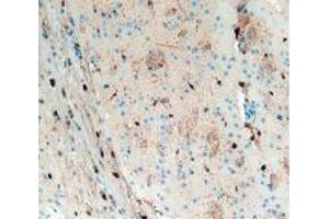 IHC-P analysis of Mouse Brain Tissue, with DAB staining. (S100B antibody  (AA 1-92))