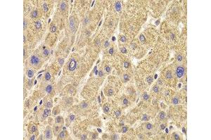 Immunohistochemistry of paraffin-embedded Human liver damage using PEX5 Polyclonal Antibody at dilution of 1:100 (40x lens).