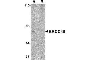 Western blot analysis of BRCC45 in HeLa cell lysate in (A) the absence and (B) presence of blocking peptide with AP30165PU-N BRCC45 antibody at 1 μg/ml. (BRE antibody  (N-Term))