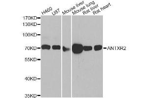 Western blot analysis of extracts of various cell lines, using ANTXR2 antibody. (ANTXR2 antibody  (AA 339-488))