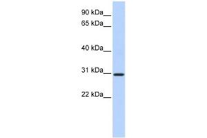 WB Suggested Anti-BCAS2 Antibody Titration:  0. (BCAS2 antibody  (N-Term))