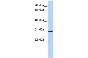 WB Suggested Anti-BCAS2 Antibody Titration:  0.